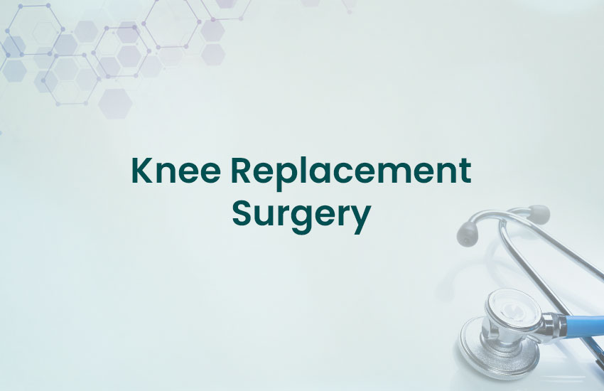 Knee Replacement Surgery