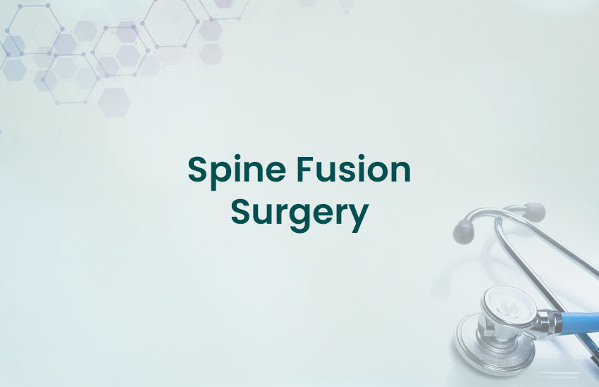 Spine Fusion Surgery