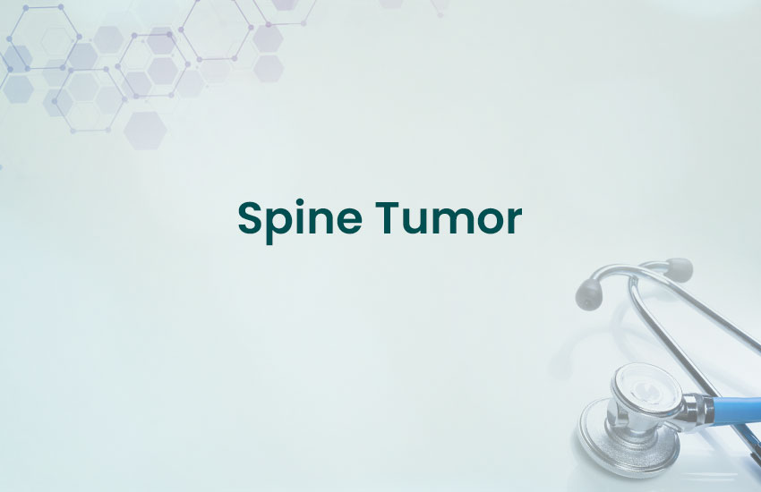 Spine Tumor